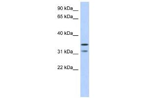 Western Blotting (WB) image for anti-Retinoic Acid Induced 12 (RAI12) antibody (ABIN2459706)