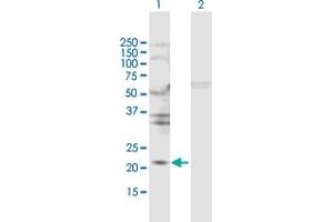 Western Blot analysis of TIMP2 expression in transfected 293T cell line by TIMP2 MaxPab polyclonal antibody. (TIMP2 anticorps  (AA 1-220))