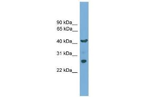 TMEM176A antibody used at 0. (TMEM176A anticorps  (N-Term))