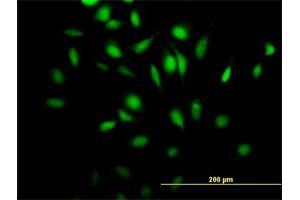 Immunofluorescence of purified MaxPab antibody to Rgr on HeLa cell. (RGL4 anticorps  (AA 1-410))