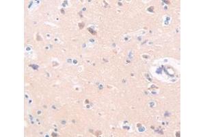 Figure. (Afamin anticorps  (AA 22-210))