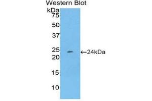 Western Blotting (WB) image for anti-Pentraxin 3 (PTX3) (AA 195-381) antibody (ABIN1860373) (PTX3 anticorps  (AA 195-381))