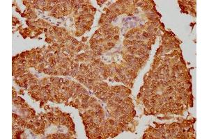 IHC image of ABIN7127548 diluted at 1:130.