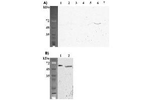 Western blot analysis using anti-FTO (mouse), mAb (FT62-6)  at 1:2'000 dilution.