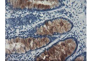 Image no. 3 for anti-F-Box Protein 42 (FBXO42) (AA 356-717) antibody (ABIN1491450) (FBXO42 anticorps  (AA 356-717))