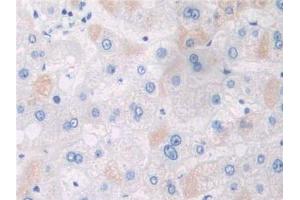 DAB staining on IHC-P; Samples: Human Liver Tissue