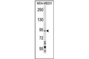Western blot analysis of MAD1L1 Antibody (N-term) in MDA-MB231 cell line lysates (35ug/lane). (MAD1L1 anticorps  (N-Term))