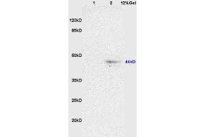 L1 rat brain lysates L2 rat heart lysates probed with Anti NK-2R/Neurokinin A Polyclonal Antibody, Unconjugated (ABIN725315) at 1:200 overnight at 4 °C. (TACR2 anticorps  (AA 223-300))