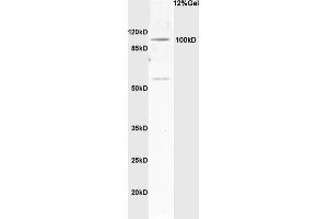 Rat brain lysates probed with Anti Synphilin-1 Polyclonal Antibody, Unconjugated (ABIN736163) at 1:200 in 4 °C.