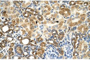 Human kidney (TAM41 anticorps  (N-Term))