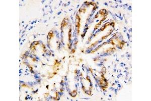 IHC-P: Calpain 1 antibody testing of rat lung tissue (CAPN1 anticorps  (Middle Region))