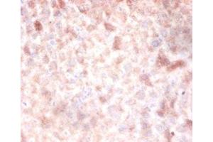 Immunohistochemistry of paraffin-embedded mouse liver tissue using ABIN7150112 at dilution of 1:100 (DNMT3A anticorps  (AA 680-902))