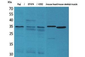 Western Blotting (WB) image for anti-Claudin 17 (CLDN17) (C-Term) antibody (ABIN3180987) (Claudin 17 anticorps  (C-Term))