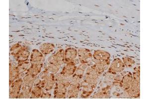 ABIN6267336 at 1/200 staining Rat ganstric tissue sections by IHC-P.