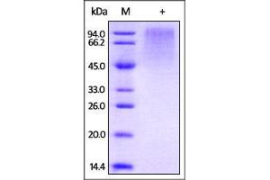 HRSV (A) glycoprotein G on SDS-PAGE under reducing (R) condition.