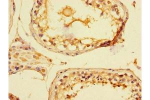 Immunohistochemistry of paraffin-embedded human testis tissue using ABIN7169145 at dilution of 1:100 (PIM2 anticorps  (AA 1-210))