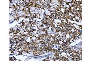 IHC analysis of NUMB using anti-NUMB antibody (ABIN3043374). (NUMB anticorps  (N-Term))