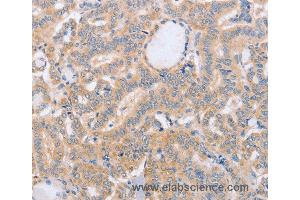 Immunohistochemistry of Human brain  using BST1 Polyclonal Antibody at dilution of 1:40 (BST1 anticorps)