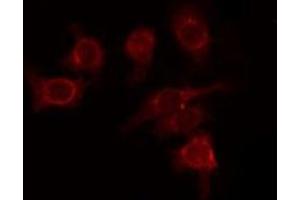 ABIN6277736 staining HepG2 by IF/ICC.