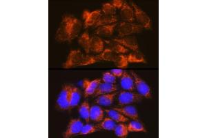 Immunofluorescence analysis of HeLa cells using IFN Rabbit pAb (ABIN7267947) at dilution of 1:100 (40x lens).