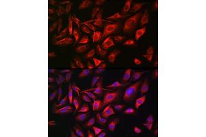 Immunofluorescence analysis of U-2 OS cells using TGN46/TGN46/TGOLN2 Rabbit pAb (ABIN7270876) at dilution of 1:100 (40x lens).