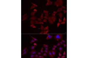 Immunofluorescence analysis of MCF7 cells using NPHP1 Polyclonal Antibody (NPHP1 anticorps)