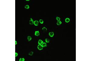 IHC analysis of Cyclophilin A using anti-Cyclophilin A antibody .