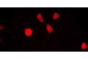 Immunofluorescent analysis of ING5 staining in A549 cells. (ING5 anticorps)
