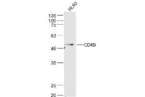 Human HL-60 lysates probed with CDK9 Polyclonal Antibody, Unconjugated  at 1:500 dilution and 4˚C overnight incubation. (CDK9 anticorps  (AA 231-372))