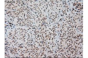 Immunohistochemical staining of paraffin-embedded kidney using anti-HES1 (ABIN2452569) mouse monoclonal antibody.