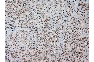 Immunohistochemical staining of paraffin-embedded kidney using anti-HES1 (ABIN2452569) mouse monoclonal antibody.