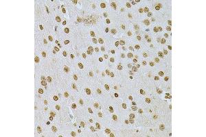 Immunohistochemistry of paraffin-embedded mouse brain using ILK Antibody. (ILK anticorps  (AA 1-260))