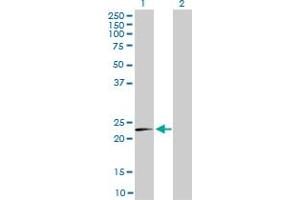 Western Blot analysis of MRPL12 expression in transfected 293T cell line by MRPL12 monoclonal antibody (M01), clone 3B12-1A3.