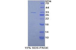 SDS-PAGE (SDS) image for Kallikrein 9 (KLK9) (AA 1-254) protein (His tag) (ABIN1878993) (Kallikrein 9 Protein (KLK9) (AA 1-254) (His tag))