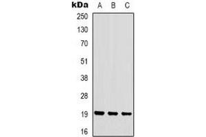 Western blot analysis of STMN1 (pS16) expression in HEK293T (A), Hela (B), Jurkat (C) whole cell lysates. (Stathmin 1 anticorps  (N-Term, pSer16))