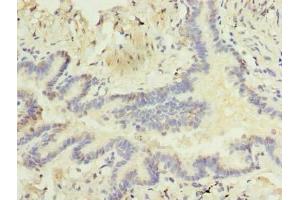 Immunohistochemistry of paraffin-embedded human lung tissue using ABIN7168256 at dilution of 1:100 (RNF24 anticorps  (AA 45-148))