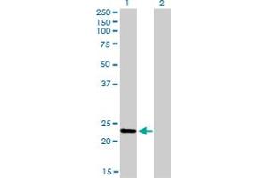 Western Blot analysis of RAB9A expression in transfected 293T cell line by RAB9A monoclonal antibody (M01), clone 1E12. (RAB9A anticorps  (AA 17-115))