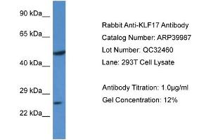 WB Suggested Anti-KLF17 Antibody Titration:  0. (KLF17 anticorps  (N-Term))