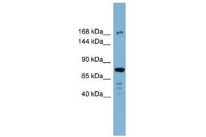 DAPK1 antibody used at 1 ug/ml to detect target protein. (DAP Kinase 1 anticorps  (N-Term))