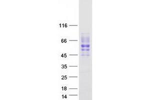 Validation with Western Blot