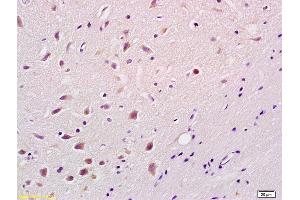 Formalin-fixed and paraffin embedded rat brain labeled with Rabbit Anti phospho-Bim(Ser87) Polyclonal Antibody, Unconjugated (ABIN682873) at 1:200 followed by conjugation to the secondary antibody and DAB staining (BIM anticorps  (pSer87))