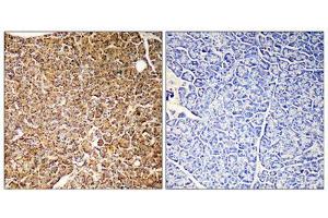 Immunohistochemistry (IHC) image for anti-Phosphoinositide-3-Kinase, Catalytic, gamma Polypeptide (PIK3CG) (Internal Region) antibody (ABIN1852676) (PIK3 gamma anticorps  (Internal Region))