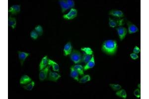 Immunofluorescence staining of Hela cells with ABIN7168815 at 1:33, counter-stained with DAPI. (SEMA5B anticorps  (AA 845-1013))