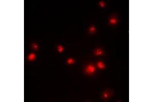 Immunofluorescent analysis of EZH2 staining in MCF7 cells.