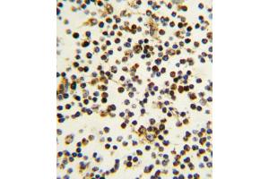Immunohistochemistry (IHC) image for anti-Nucleophosmin (Nucleolar phosphoprotein B23, Numatrin) (NPM1) antibody (ABIN3001656) (NPM1 anticorps)