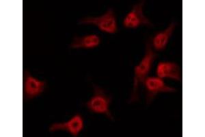 ABIN6274111 staining HuvEc by IF/ICC. (NEMF anticorps  (C-Term))
