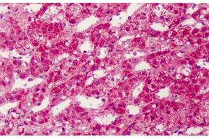 Human Adrenal: Formalin-Fixed, Paraffin-Embedded (FFPE) (PPARG anticorps  (Internal Region))