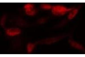 anti-SUMO1/sentrin/SMT3 Specific Peptidase 2 (SENP2) antibody