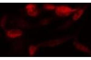 ABIN6278347 staining  MDA-MB-435 cells by IF/ICC. (SENP2 anticorps)