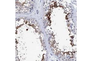Immunohistochemical staining of human testis with SPATA7 polyclonal antibody  shows strong cytoplasmic positivity in a subset of cells in seminiferous tubules. (SPATA7 anticorps)